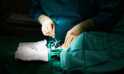 Ospedale Alessandria: intervento innovativo in cardiochirurgia su paziente 81enne