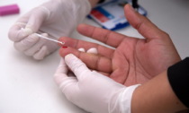 Piemonte: in calo nuove infezioni da HIV