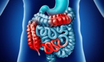 Arriva in Piemonte la campagna per sensibilizzare sulla malattia di Crohn