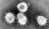 Coronavirus, CGIL FP Vercelli: "È un bollettino di guerra"