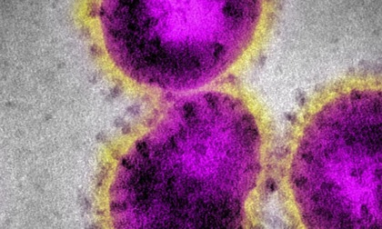 Coronavirus: sotto osservazione sorella del torinese in isolamento