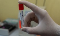 Coronavirus: calano ancora i domiciliati nell'Alessandrino